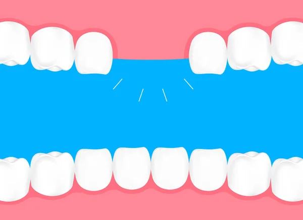 입에서 인간의 이빨입니다 그래픽 개념입니다 파란색 배경에 — 스톡 벡터