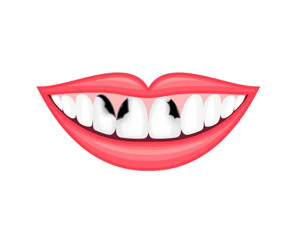 Carie Dentaire Des Dents Malsaines Bouche Humaine Concept Soins Dentaires — Image vectorielle