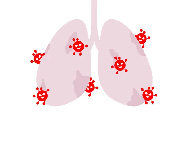 Choroba Płuc Wirusem Komórki Wirusowe Jedzące Płuca Uszkodzone Płuco Koronawirusem — Wektor stockowy