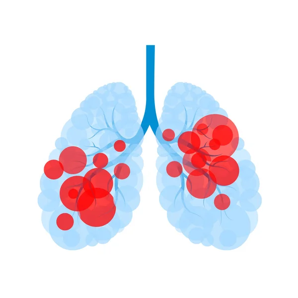 Círculo Rojo Forma Pulmón Humano Enfermedad Pulmonar Con Virus Células — Vector de stock