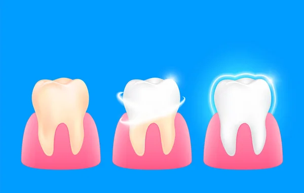 Conjunto Dentes Limpos Sujos Passo Amarelo Branco Dental Care Concept — Vetor de Stock