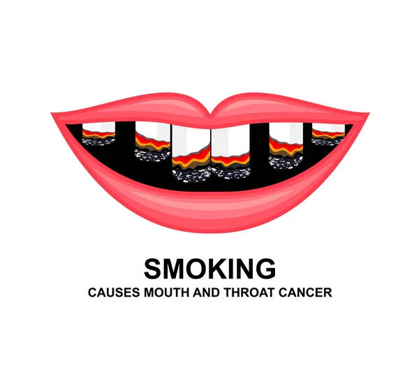Cigarro Boca Humana Fumar Causa Danos Aos Dentes Mundo Sem —  Vetores de Stock
