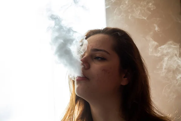 Wapnący Nastolatek Problemem Skórnym Portret Młodej Słodkiej Dziewczyny Palącej Elektronicznego — Zdjęcie stockowe