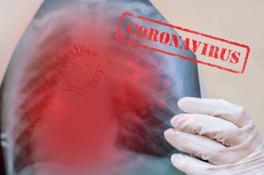 Doktorun el pulmonoloğu tıbbi eldiven ile hastanın akciğerlerinin röntgenini inceliyor. Salgın covid-19 koronavirüs. Viral pnömoni ncov tespiti. Sağlığa. Sağlık Kırmızı İşaret damgası, virüs resmi