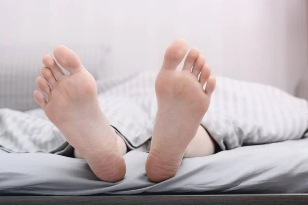 Women's dry cracked feet, heels in bed. Skin care — Stock Photo, Image