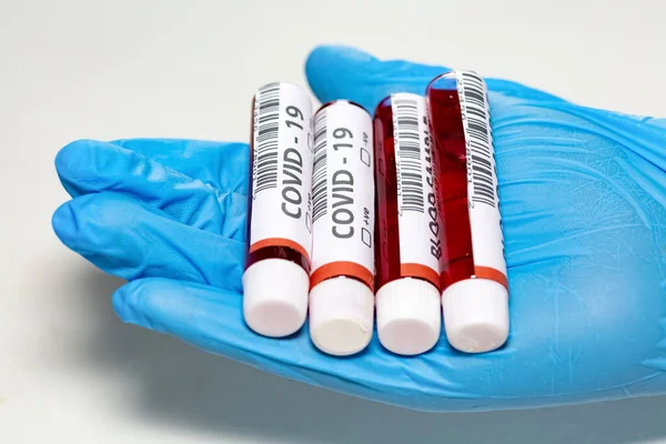 Blood sample vials of patients on the palm of the hand of a medical examiner wearing gloves in close up view