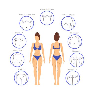 Plastik cerrahi kadın vücut Infographics. Vektör