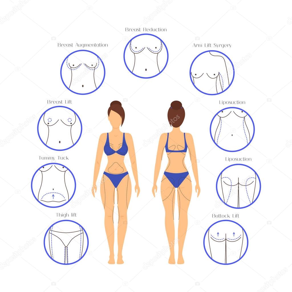 Plastic Surgery Woman Body Infographics. Vector