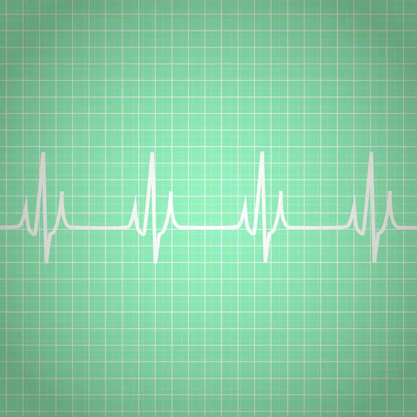 O coração bate fundo do cardiograma. Vetor —  Vetores de Stock