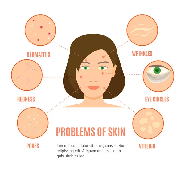 Girl Skincare Diferentes problemas Tarjeta o Poster Vector — Vector de stock