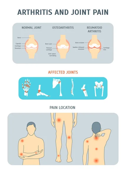 Artrite dei cartoni animati e dolori articolari. Vettore — Vettoriale Stock