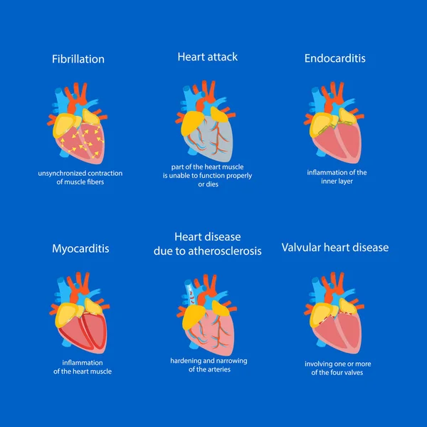 Conjunto de doenças cardíacas dos desenhos animados. Vetor —  Vetores de Stock