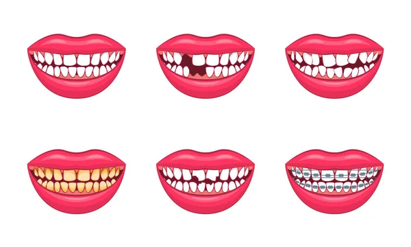 Ρεαλιστική λεπτομερείς 3d σύνολο οδοντικά προβλήματα. Διάνυσμα — Διανυσματικό Αρχείο