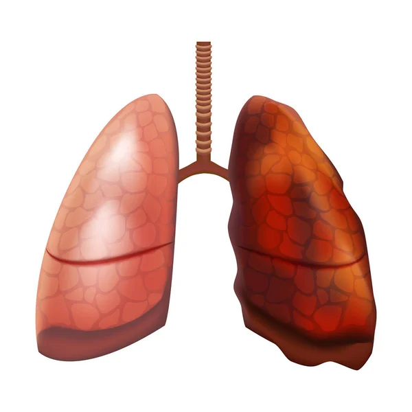 Realistische detaillierte 3D-Darstellung des inneren Organs der menschlichen Lunge. Vektor — Stockvektor