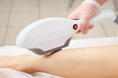 Güzellik uzmanı bacaklarına lazer epilasyon uyguluyor.