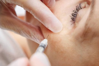 Klinik uzmanı hyaluronik asit jeli enjekte ediyor.