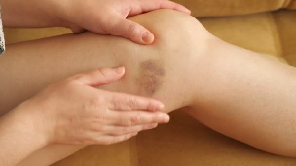 Mujer examina y siente el moretón en su pierna — Vídeos de Stock