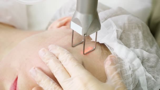 Terapeuta faz procedimento de remoção de cabelo a laser no rosto do paciente — Vídeo de Stock