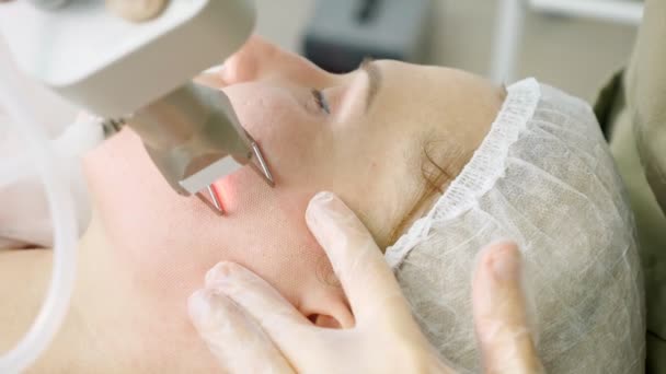 Terapeuta sprawia, że laserowe usuwanie włosów na twarzy pacjenta — Wideo stockowe