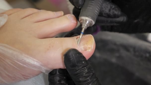 Pedicure perangkat keras di salon. Sang master memproses kuku yang rusak. Close-up — Stok Video