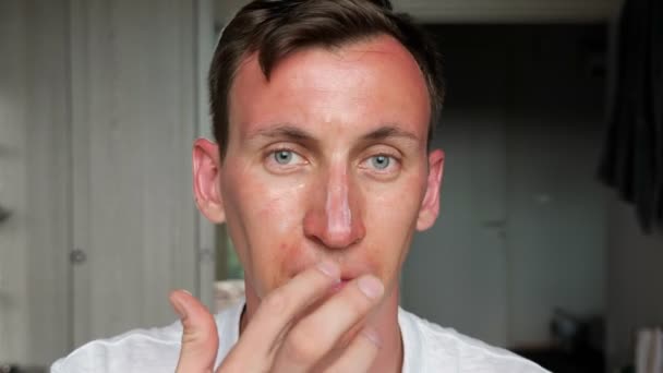 Homme aux yeux bleus applique crème brûlante blanche sur le nez avec les doigts — Video