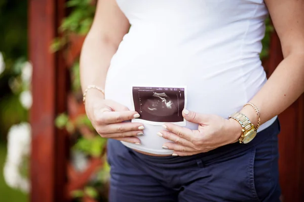 Крупным планом изображение беременной женщины, касающейся живота руками — стоковое фото