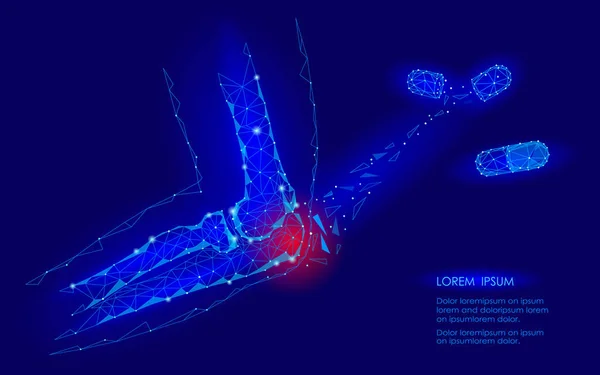 Medicamento cápsula cura la enfermedad articular del codo. Área de dolor rojo baja tecnología de concepto de medicina futura geomentíca poli. Ciencia de la medicina de innovación. Brazo cúbito lesión conexión poligonal vector ilustración — Vector de stock