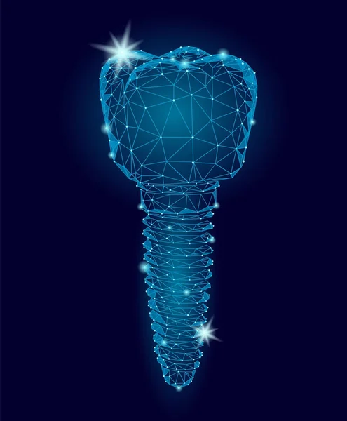 Implante dental molar modelo geométrico polivinílico bajo 3d. Odontología innovación tecnología futura titán hilo de metal. Médico ciencia sana azul poligonal punto línea vector ilustración — Archivo Imágenes Vectoriales