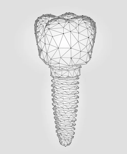 Implante dental molar modelo geométrico polivinílico bajo 3d. Odontología innovación tecnología futura titán hilo de metal. Médico ciencia sana abstracto gris blanco poligonal punto línea vector ilustración — Vector de stock