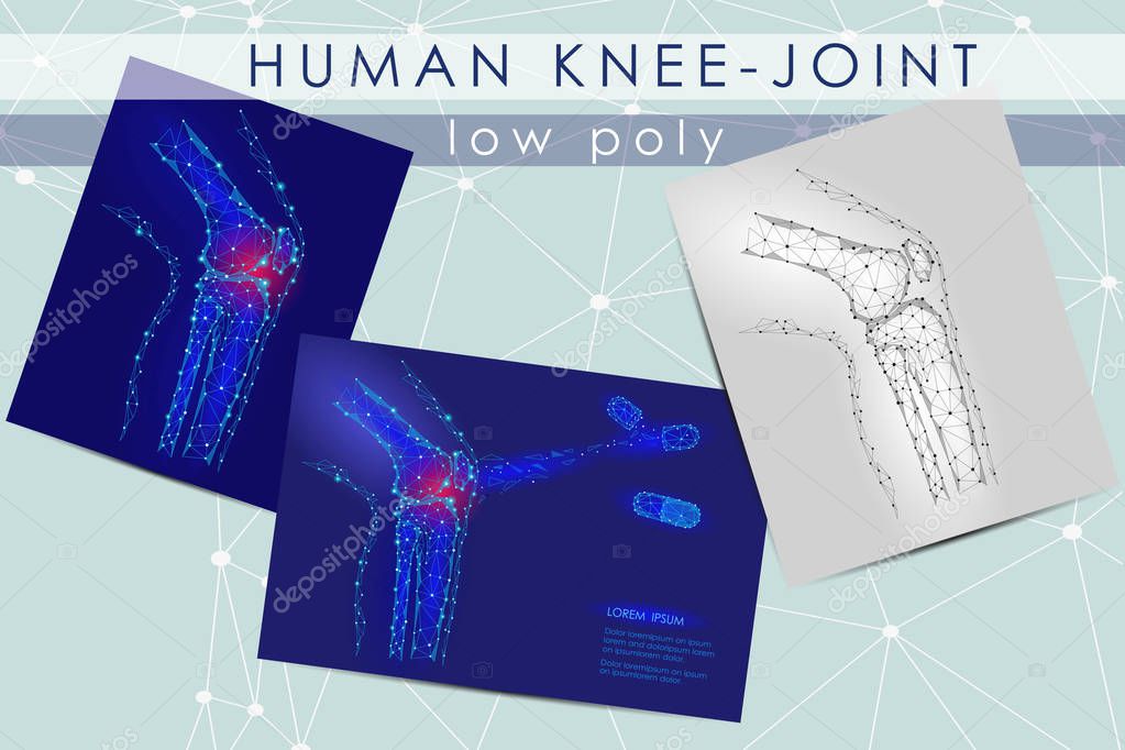 Human knee-joint low poly medicine science illustration set. Knee anatomical pain cure concept. Help keep health drug mechanism action on joint vector polygonal geometric point line art