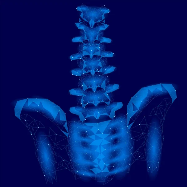 Mänskliga ryggraden hip ryggradens radiculitis smärta låg poly. Geometriska polygonal partikel triangel punkt linje framtida medicin teknik blå vektorillustration — Stock vektor