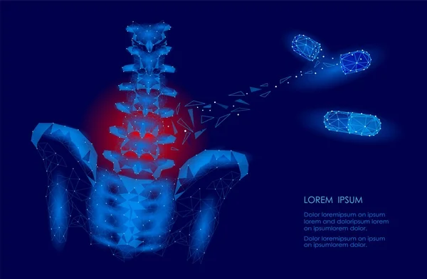 Espina dorsal humana cadera radiculitis lumbar dolor bajo poli. Geométrica poligonal partícula triángulo punto línea futura medicina tecnología azul rojo doloroso área vector ilustración — Vector de stock