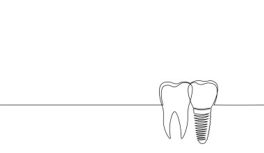 Tek sürekli çizgi sanat anatomik insan dişi siluet implant. Sağlıklı tıp kurtarma molar kökü kavite kavramı tasarım dünya ağız sağlığı gün bir vektör çizim çizim anahat eskiz