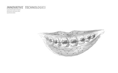 3D ortodontik diş telleri. Wonam gülümseme diş eğitmeni. Diş Tiyatrosu Sağlık Hizmetleri Tıbbi Afişi. Düşük polimer tasarım dişçi düzeltmesi vektör illüstrasyonunu düzelt