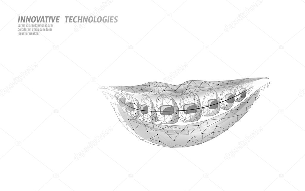 3D orthodontic braces. Wonam smile tooth trainer. Dental theatment heath care medical banner. Low poly design dentist correction fix vector illustration