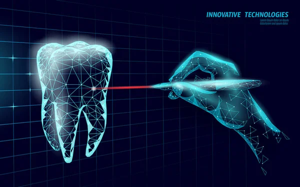 Медицинский здоровый человеческий зуб 3d. Медицинская модель низкого поли. Концепция лазерной хирургии. Стоматология веб-здравоохранения стоматолог стоматолог современная технология векторной иллюстрации — стоковый вектор