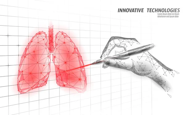 3D human lung medicine grafiek onderzoek concept. Analyse van het infectiegevaar van het ademhalingsvirus. Therapie van tuberculose ziekenhuis poster template vector illustratie — Stockvector