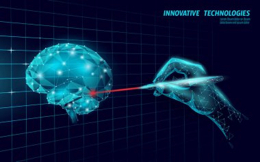 Beyin tedavisinde düşük polimerli 3D görüntüleme. Alzheimer hastalığı ve bunama vektör illüstrasyonunda tıp bilişsel lazer rehabilitasyonu