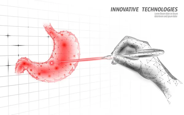 Cirugía láser del estómago humano operación baja poli. Medicina enfermedad tratamiento de drogas área dolorosa. Forma de renderizado 3D poligonal de triángulos rojos. Farmacia negocio cartel plantilla vector ilustración — Vector de stock