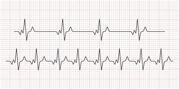 Cardiogramme. Rythme cardiaque. Ligne de battement de coeur. Électrocardiogramme. Vecteur — Image vectorielle