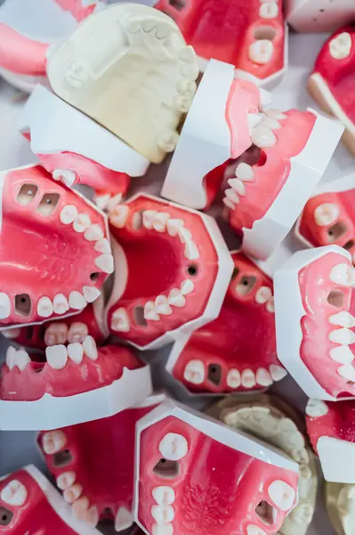 Caixa Cheia Modelos Gesso Dental — Fotografia de Stock