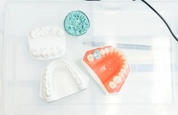 Vista Superior Del Recipiente Plástico Con Molde Dental Prótesis Utilizadas — Foto de Stock