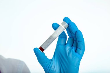 Beyaz önlüklü, lastik eldivenli, elinde test tüpü tutan doktorun fotoğrafı..