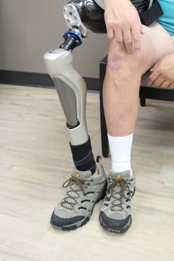 Protez bacak tutan adam, dikey görünüm