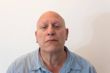 Yaşlı adam kötü tavırlı, kel, alopecia, kemoterapi, kanser, beyaz, dikey açıdan izole edilmiş.