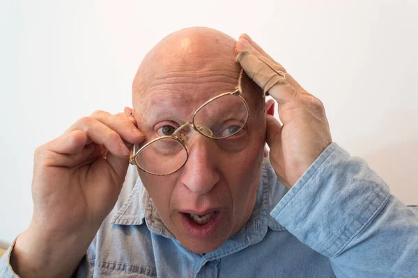 眼鏡をかけた高齢者 脱毛症 化学療法 白に隔離された 垂直面 — ストック写真