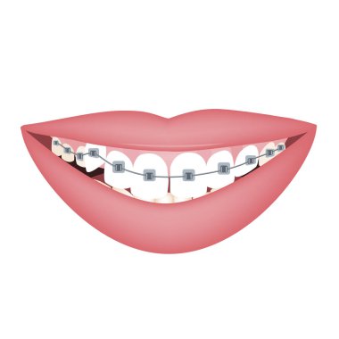 Download Corrects Free Vector Eps Cdr Ai Svg Vector Illustration Graphic Art