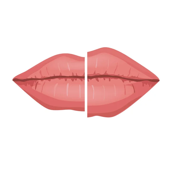 Kvinnliga läppar före och efter fyllnadsinjektioner, vektor Infografisk illustration. Vackra och sexiga perfekta läppar isolerade på vit bakgrund — Stock vektor