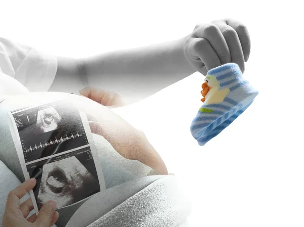 아기 신발과 흰색 배경에 고립 된 초음파 스캔을 들고 임신한 여자의 두 배 exproure. 임신 건강 관리의 개념. 스톡 이미지