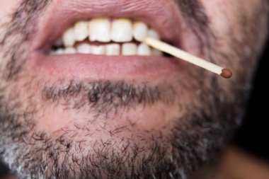 Tıraşsız bir adamın dişlerindeki kibrit..